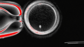 Protivnik kojeg čovječanstvo ne može pobijediti